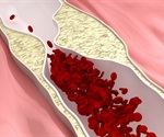 New study shows how T cells function in atherosclerosis