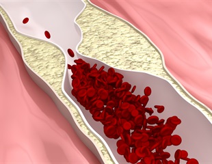 Breakthrough 3D Vascular Sheet Mimics Atherosclerosis for High-Throughput Drug Screening