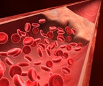 COVID-19 makes platelets 'hyperactive' and more prone to form deadly blood clots