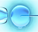 Using a microfluidic chip for selection of healthy sperm based on positive rheotaxis