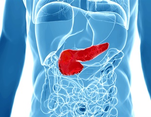 New DNA Methylation-Based Analysis Provides Accurate Assessment of Pancreas Cell Composition