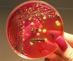 Salmonella Employs Unique Tactics to Escape Cellular Defense