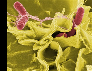 Bacterial "Vampirism" Fuels Deadly Infections