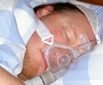 Study shows sleep apnea may be a risk factor for COVID-19