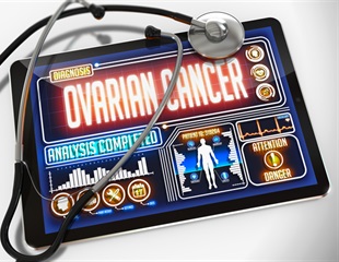 Curcumin could enhance ovarian cancer treatments