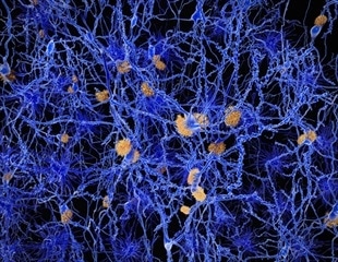 Uncovering How to Protect Nerves in Neurodegenerative Diseases