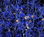 Game-Changing Research Shows Astrocytes as Key Regulators of Alzheimer's Disease Progression