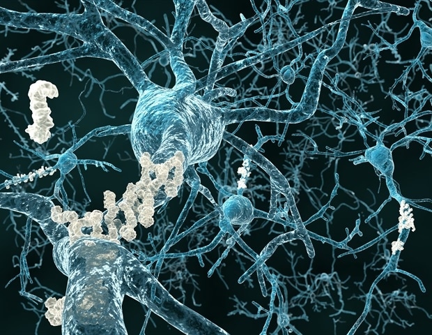 Using State-of-the Art Imaging to Understand Lipid Dysfunction in Alzheimer's