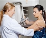 Study shows AI can enhance breast cancer detection on mammography