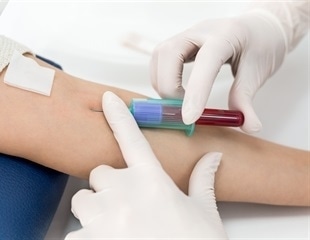 Columbia researchers develop new blood test to measure the pace of biological aging