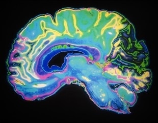 Scientists propose a theory of brain map formation