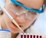 Simple blood test helps identify patients developing neurotoxic side effects