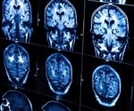 Researchers track how key brain receptor works