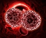 Biologists unravel the mystery behind nuclear anomaly in blood cancer cells
