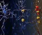 Study shows why “the brain's memory center” is vulnerable to damage, degeneration