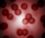 Newly Found Disease Links Disruptions of Blood Formation, Immune System and Inflammation