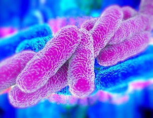 New Cost-Effective RNA Sequencing Method for Legionella Detection