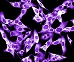 Study sheds light on the ability of melanomas to form early metastases