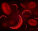 New technology rapidly diagnoses sickle cell disease
