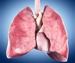Severe lung injuries can trigger stem cells to undergo abnormal differentiation, study finds