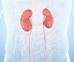 Innovative technique encourages cancer cells in the kidneys to self-destruct