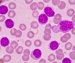 Dual inhibitor therapy may be safer for patients with chronic lymphocytic leukemia
