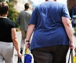 Blunted inflammatory response could make obese patients more susceptible to severe COVID-19