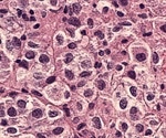 Heparin blocks SARS-CoV-2 infection in cell studies
