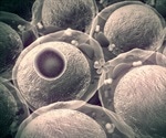 Scientists identify gene crucial to sperm cell production