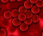 Synthetic red blood cells mimic favorable properties of natural ones