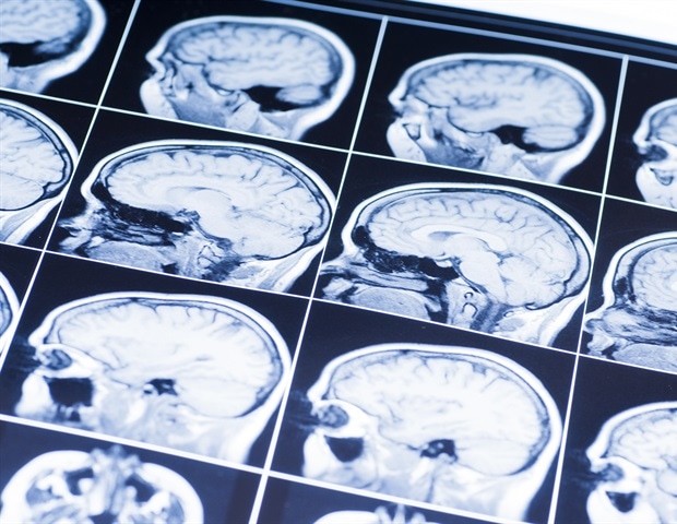 Unveiling Cannabinoid’s Potential for Treating Age-Related Brain Degeneration