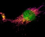 Experts use super-resolution microscopy to observe individual synapse proteins
