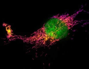 SFU-UBC Collaboration Pushes Frontiers of Cellular Biology With AI-Enhanced Super-Resolution Microscopy