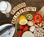 Finding ways to tackle food allergies at the source