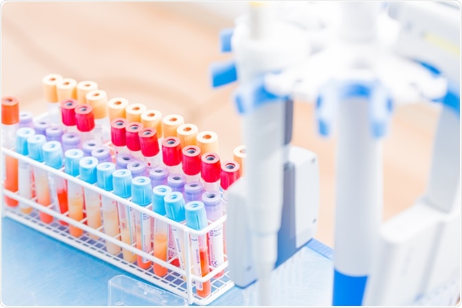 BD Vacutainer tubes, vacuum tubes for collecting blood samples in the lab. Image Credit: science photo / Shutterstock