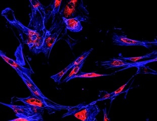 Manipulating immune cells to suppress the growth of some solid tumors
