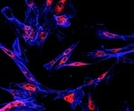 New project to make better fluorescent tags turns into a method to kill tumors