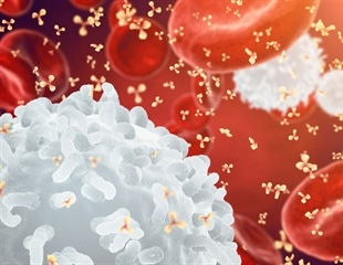 Attaching Microbubbles to Macrophages can Create Tracking Images for Tumor Diagnosis