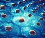 Study shows potential of human mesenchymal stem cells in treating NTM lung infection