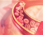 Study shows statins have different effects on different parts of the body