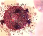 Iron-dependent cell death can be used to improve immunotherapies against liver cancer