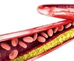 Cholesterol-lowering medication improves function of the coronary arteries