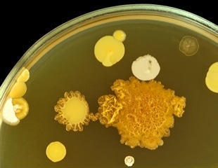 Mutation in E. coli's Cellulose Machinery Unveiled as Cause of Severe Infections