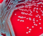 Genetic mutations allow great development of TB-causing bacteria