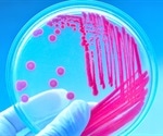 Researchers Discover Achilles Heel of Staphylococcus Capitis Strain