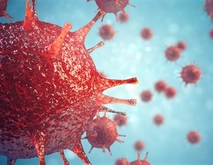 RNA Editing and Transcriptional Switching Shape Fungal Antiviral Response