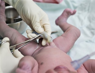 Umbilical cord blood treats children born with non-cancerous genetic disorders