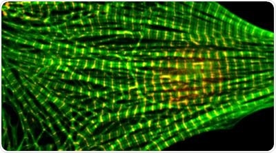 Study reveals molecular mechanism that regulate filament-like proteins in heart muscles
