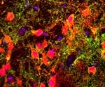 Scientists discover new genes and brain circuits crucial for short-term memory