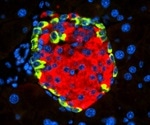 New research indicates the link between diabetes and SARS-CoV-2 viral infection